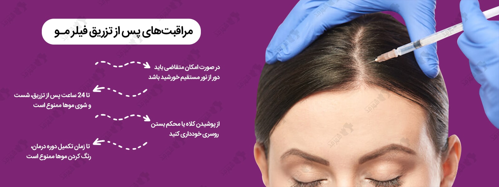 آشنایی با مراقبتهای لازم پس از تزریق فیلر مو + خرید در شهرمد